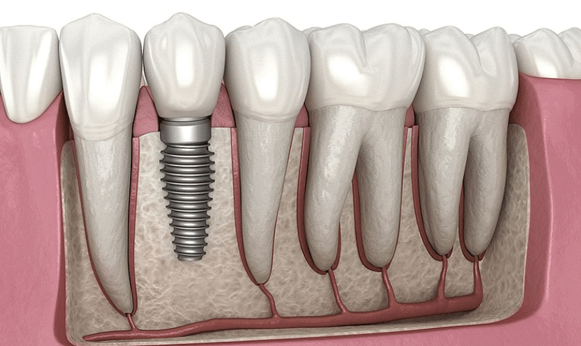 Featured image for “Does Tooth Pain Increase Days After Root Canal Treatment?”